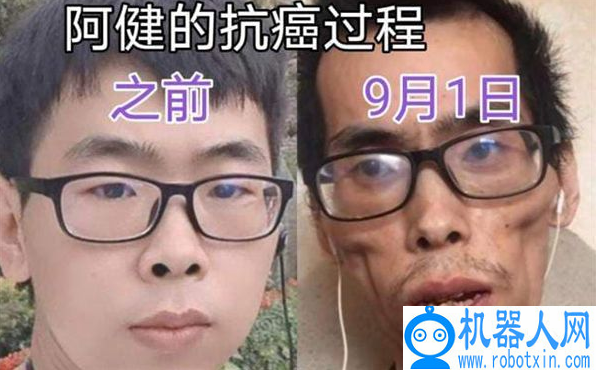 抗癌小伙阿健去世